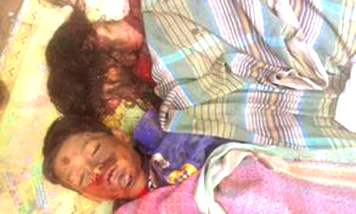 ঠাকুরগাঁওয়ে রাইস মিলের বয়লার বিস্ফোরণে নিহত-৩