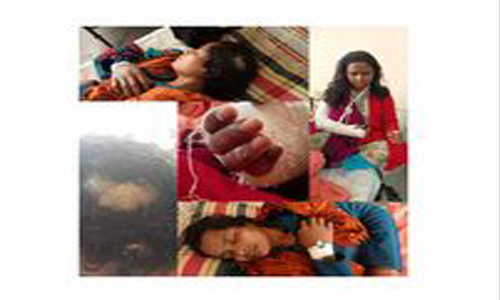 মির্জাপুরে জমি সংক্রান্ত বিষয় নিয়ে পিটিয়ে জখম,থানায় অভিযোগ