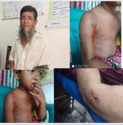 কুকুরের কামড়ে ৭ শিশুসহ ২৬ জন আহত