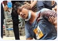 নাগরিক ভাবনা,আসিফ নজরুল: মানুষের বুকের ক্ষত দূর হবে কীভাবে