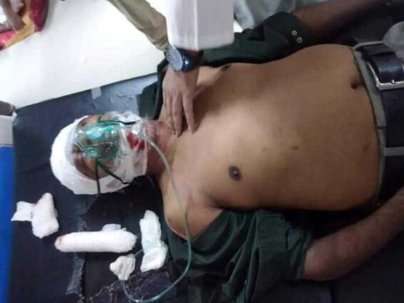 ঈদগাঁওতে সড়ক দুর্ঘটনায় আহত ব্যক্তির মৃত্যু