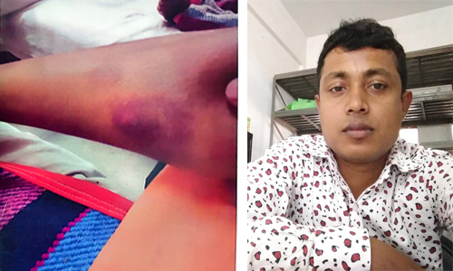 ঠাকুরগাঁওয়ে বিচারকের চেয়েও কঞ্চির গরম বেশী,যৌতুকের জন্য স্ত্রীকে টর্চার