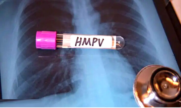 এইচএমপিভি লক্ষণ আর প্রতিকারের ব্যবস্থা কী