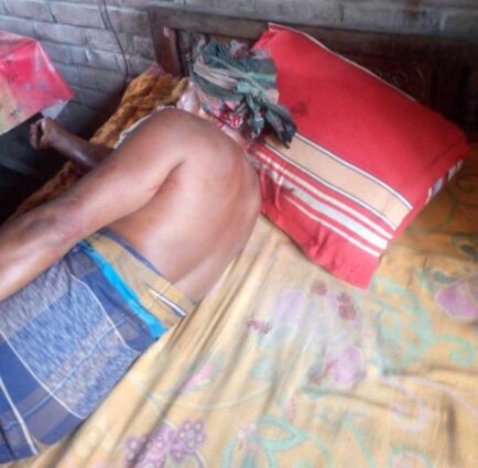 ক্ষেতে পানি দেওয়াকে কেন্দ্র করে ছোট ভাইয়ের আঘাতে বড়ভাই আহত